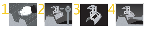 ProteaBracket 4 STEPS Illus ProteaBracket 4 STEPS Illus
